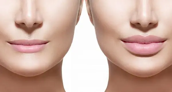 preenchimento labial