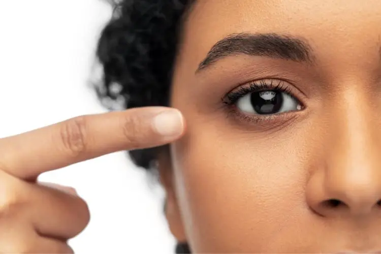 Foto do rosto de uma pessoa, especificamente da área dos olhos e do nariz. A pessoa está apontando para o olho, possivelmente indicando um procedimento de Blefaroplastia.
