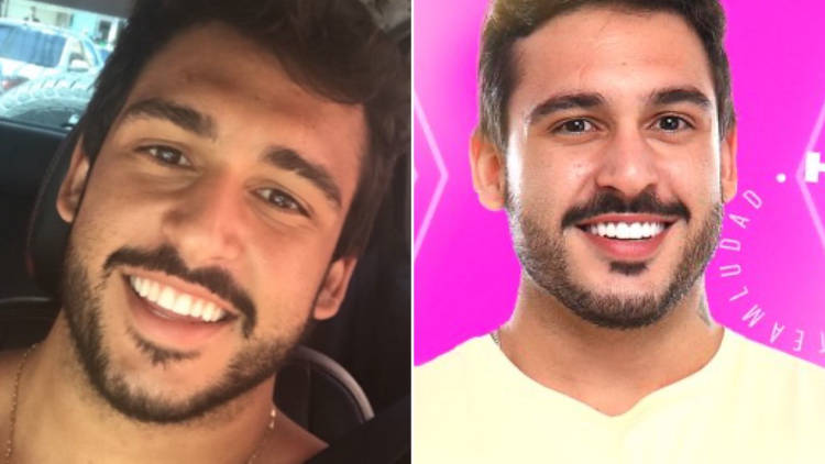 João Hadad diferença antes e depois