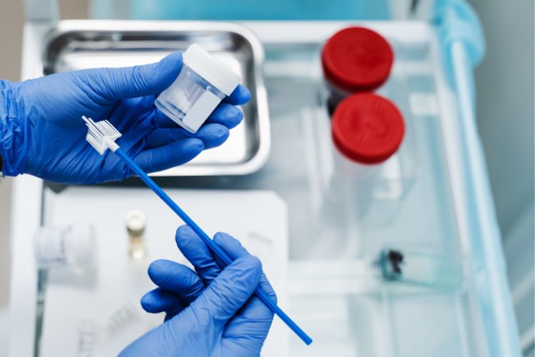 Médico usando luvas azuis e mexendo em equipamentos de exame, como potes e coletor