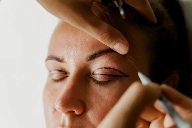 Mulher sendo desenhada nas pálpebras para realização da cirurgia de blefaroplastia