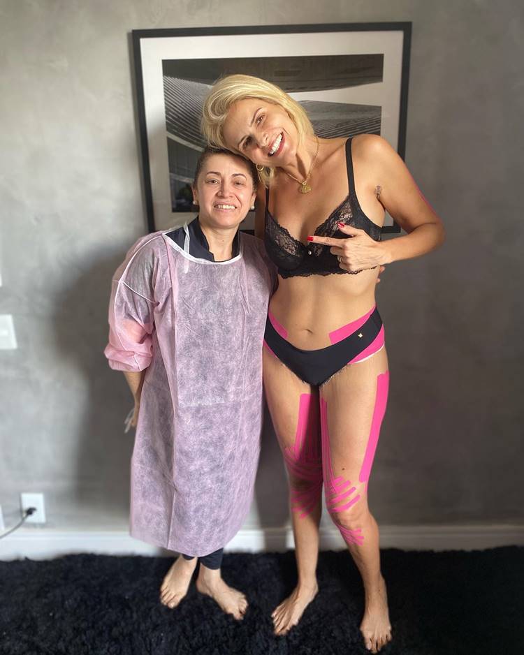 Ex-paquita Tatiana Maranhão de lingerie pós cirurgia para tratar lipedema