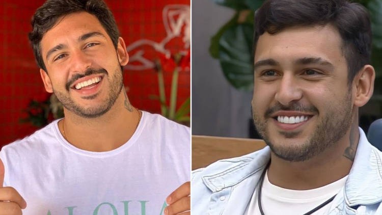 Antes e depois de João Hadad lente de contato