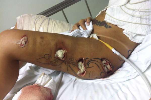 Andressa Urach no hospital- Reprodução 