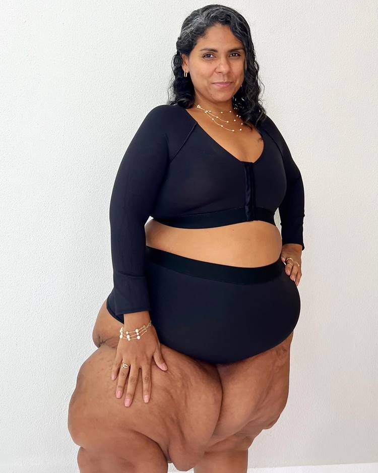 Mulher com lipedema usando roupa preta e joias de pérola