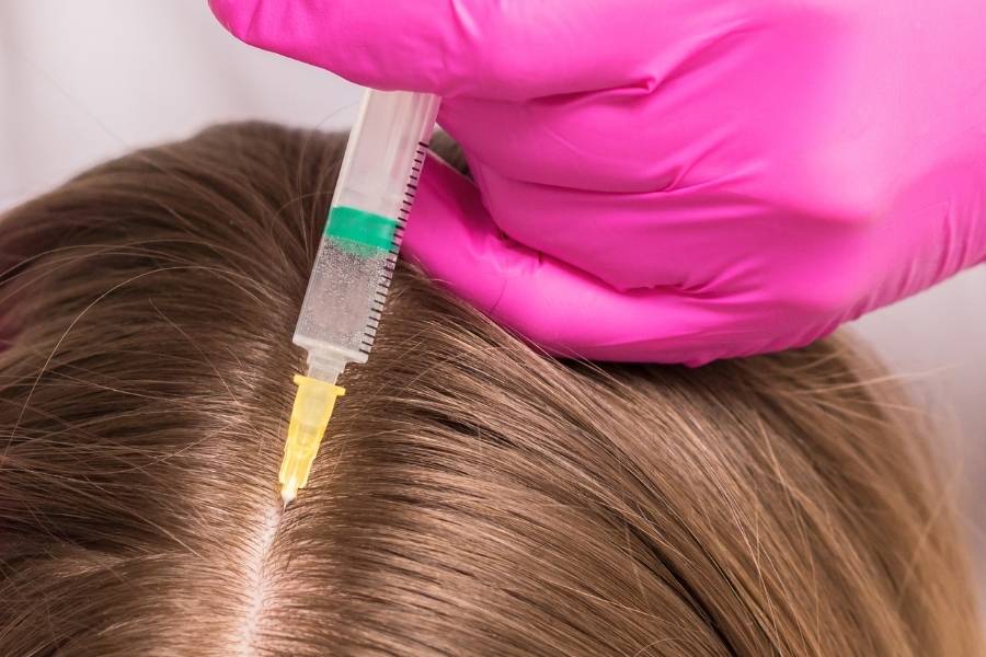 Medicamento para tratar alopecia areata.