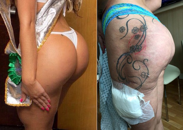 Andressa Urach no hospital- Reprodução 