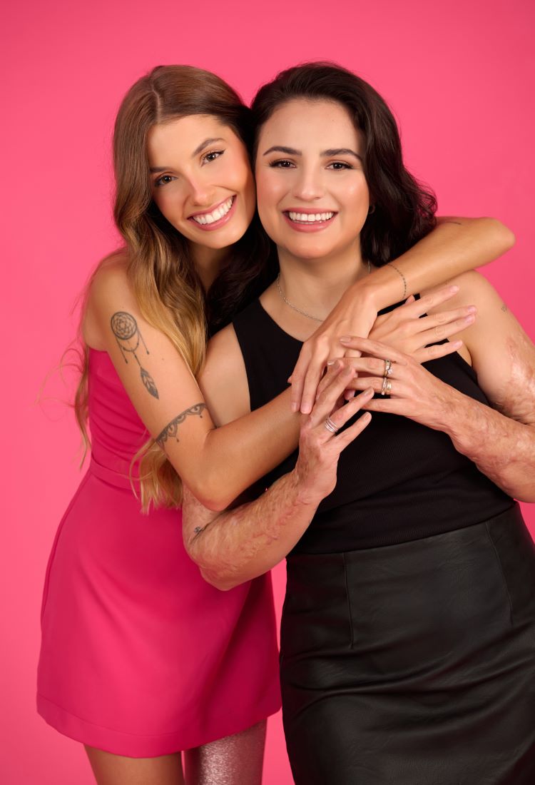 Duas mulheres sorridentes representam as Barbie brasileiras PCDs. À esquerda, uma usa vestido rosa, exibindo prótese brilhante e tatuagem. À direita, outra veste blusa preta e saia de couro, com cicatrizes visíveis. Fundo rosa celebra diversidade, inclusão e amizade.