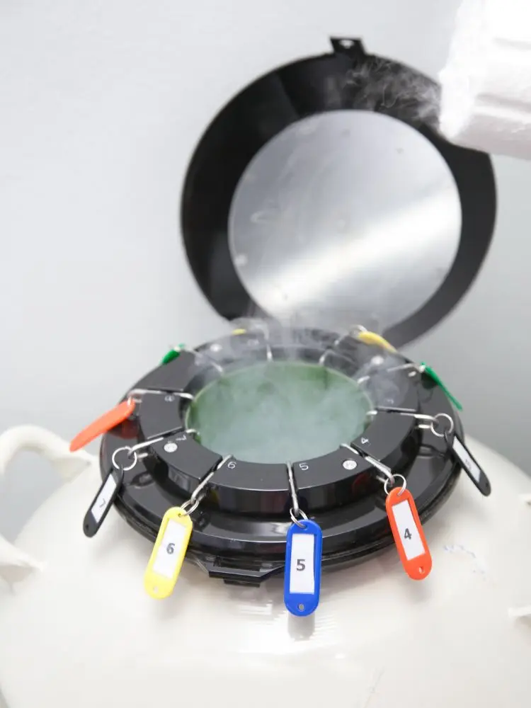 Máquina de congelar óvulos com etiquetas numeradas e coloridas