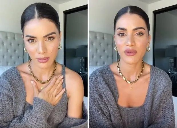 Camila Coelho desabafa sobre epilepsia