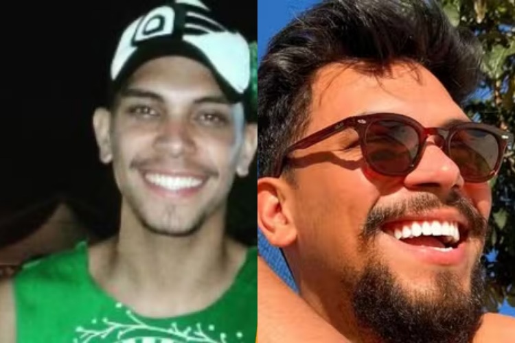 Foto de antes e depois do Vinícius do BBB 25
