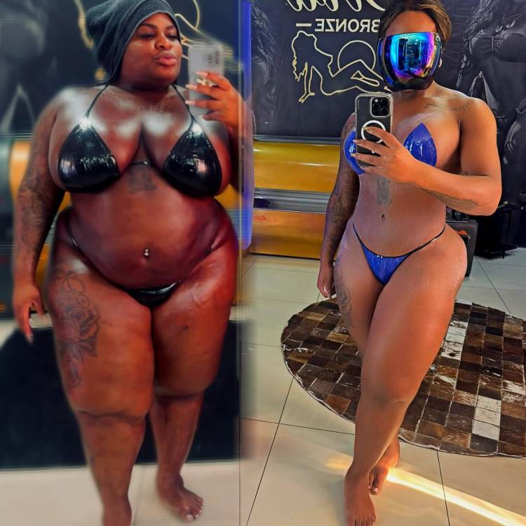 Duas fotos lado a lado mostram Jojo Todynho antes e depois da cirurgia bariátrica. À esquerda, de biquíni preto e touca. À direita, de biquíni azul metálico e óculos de sol, mostrando o resultado da perda de peso.