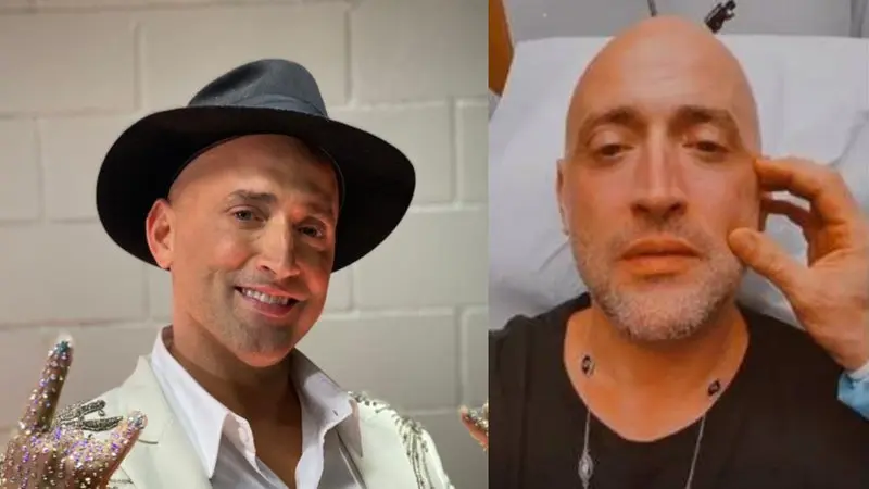 Paulo Gustavo desabafa sobre botox