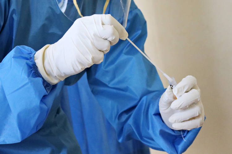PCR é um dos testes rápidos para diagnosticar Covid-19.