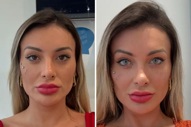 Foto de Antes e depois da cor dos olhos de Andressa Urach