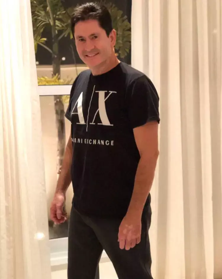Cantor com vitiligo.