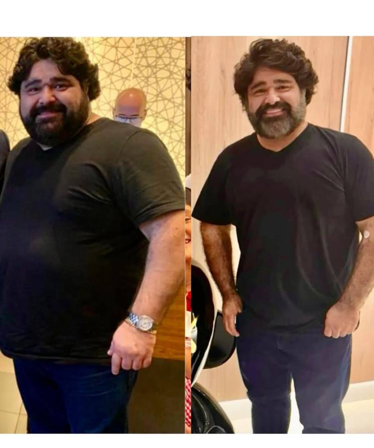 Duas fotos lado a lado mostram o cantor Fabiano Menotti antes e depois de emagrecer. Na foto da esquerda, ele aparece com mais peso. Na da direita, ele visivelmente mais magro.