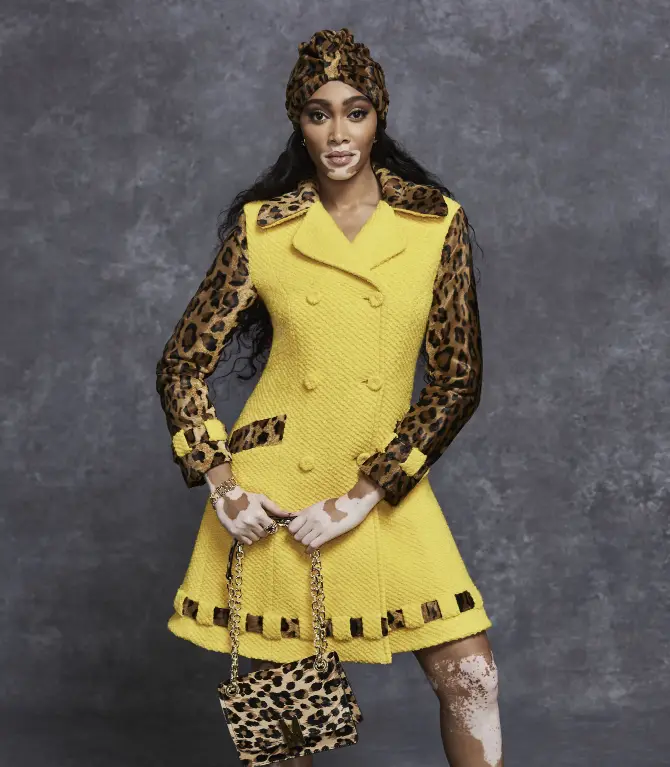 Vestido blazer com mangas de oncinha