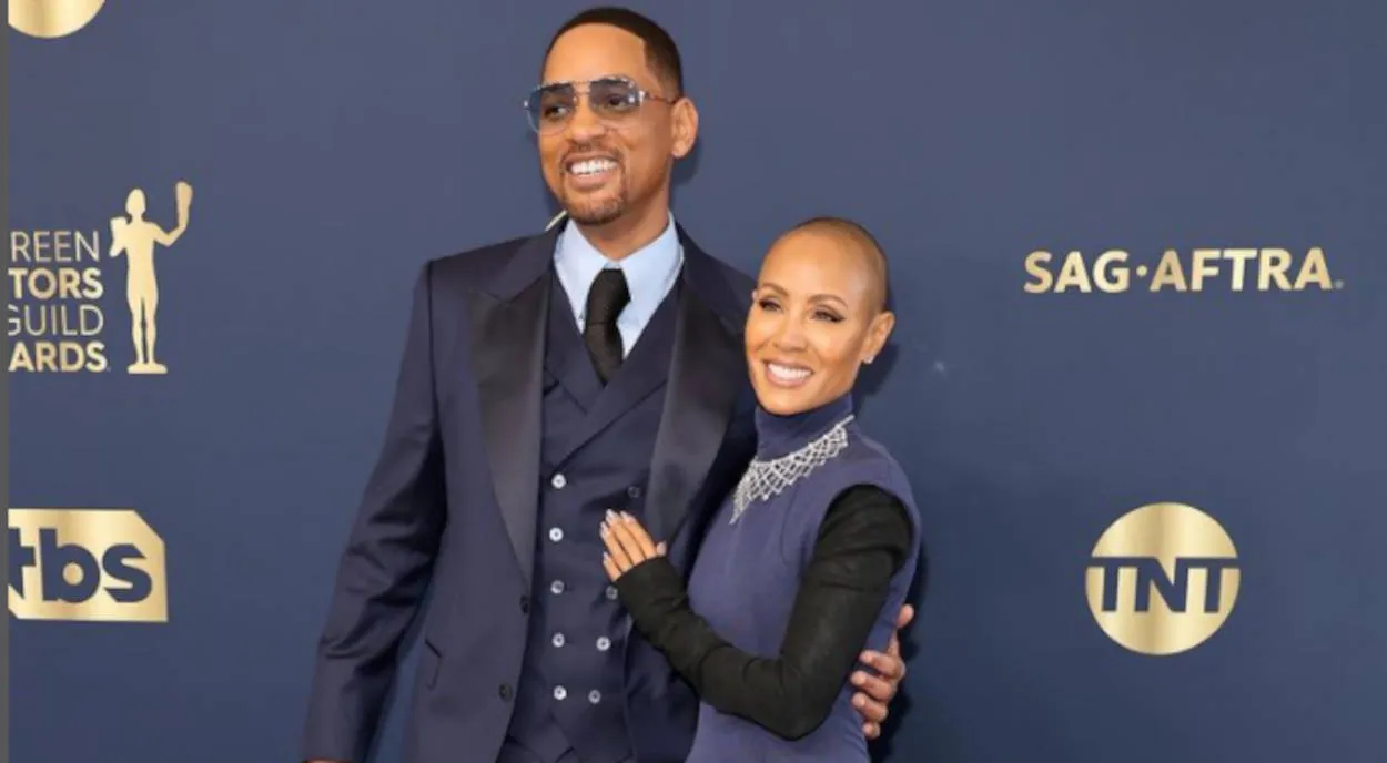 Jada com cabeça raspada por conta de alopecia.