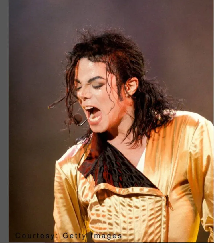 Michela Jackson tinha vitiligo.