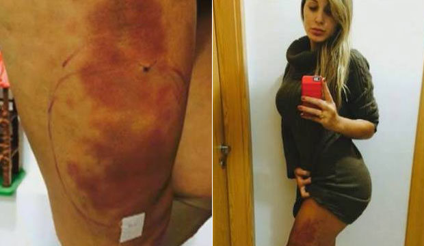 Andressa Urach no hospital- Reprodução 