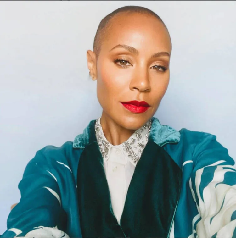 Jada possui alopecia. Jada Smith com cabelo raspado.