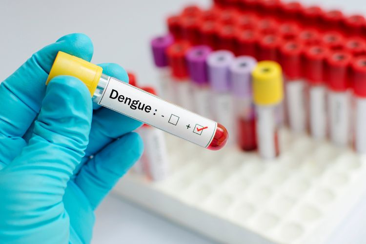 Pessoa de luva azul segurando frasco de sangue escrito "Dengue"