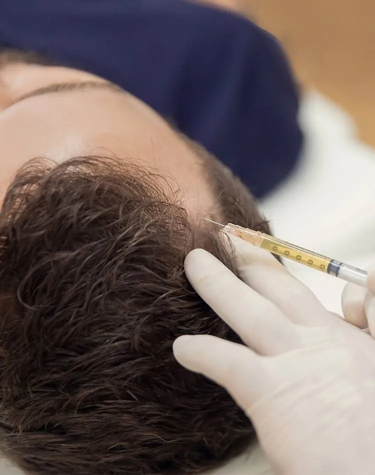 Agulha fincando no couro cabeludo. Homem fazendo tratamento contra alopecia.