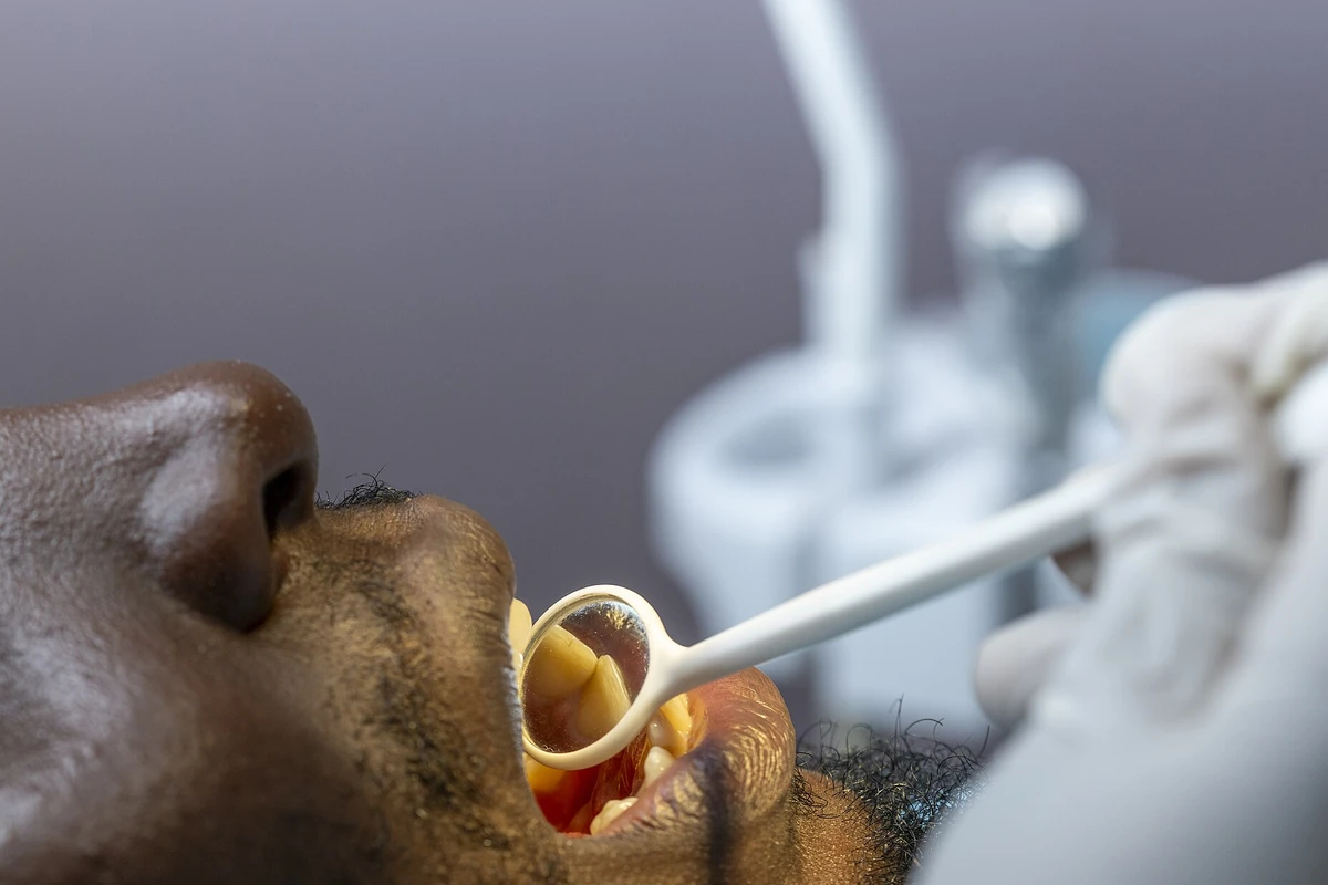 Dentista examina os dentes de um paciente com espelho bucal no consultório